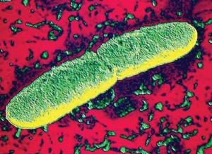 Yersinia pestis e,coli copy - Ziarul National