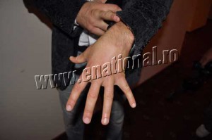 Urmele-luptei-cu-Glen-Johnson-foto-Diana-Stoica - Ziarul National