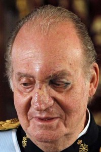 El Rey Juan Carlos, con heridas, tras golpearse con una puerta. - Ziarul National
