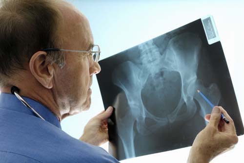 Coada calului – remediu in osteoporoza si boli de rinichi