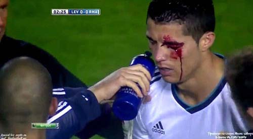 Superstarul Ronaldo – la spital in pauza meciului cu Levante