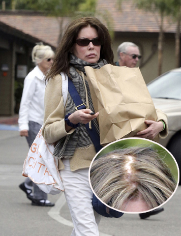 In anii ’90 facea furori in „Twin Peaks”. Astazi, Lara Flynn Boyle arata absolut INGROZITOR! (FOTO/VIDEO)