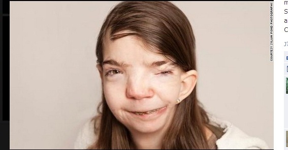 Drama unei tinere: Chiar daca are chip de monstru, este de-o frumusete extraordinara!