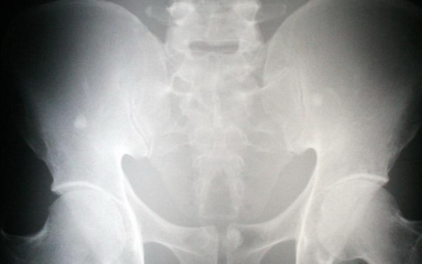 S-a prezentat la spital cu dureri GROAZNICE! Medicii au INLEMNIT cand au vazut ce avea in abdomen!