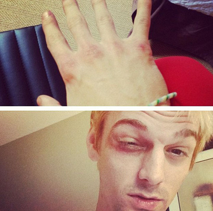 aaron carter - Ziarul National