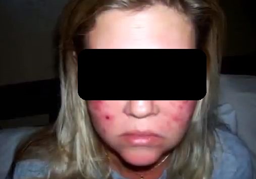 A vrut sa se faca frumoasa, dar vizita la SPA a lasat-o cu urme pe viata!