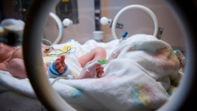 VIATA unei fetite de trei saptamani SALVATA cu ajutorul unui lipici!