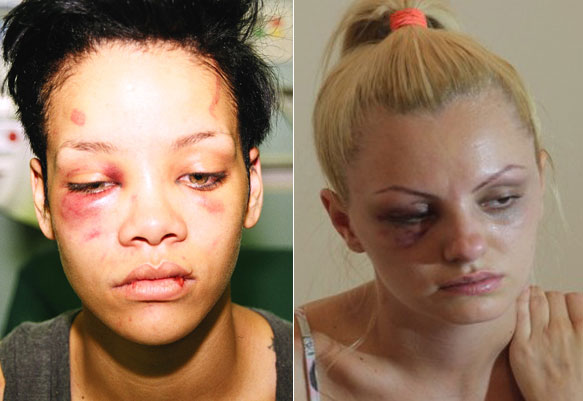„Rihanna i-ar putea propune Alexandrei Stan sa scoata un hit impreuna. Acum sunt colege de suferinta!”