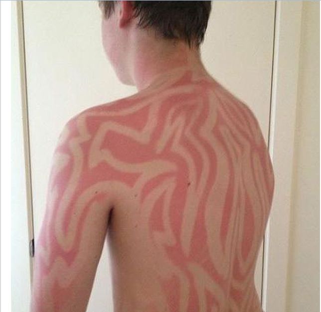 Cele mai tembele moduri de a te bronza (FOTO)