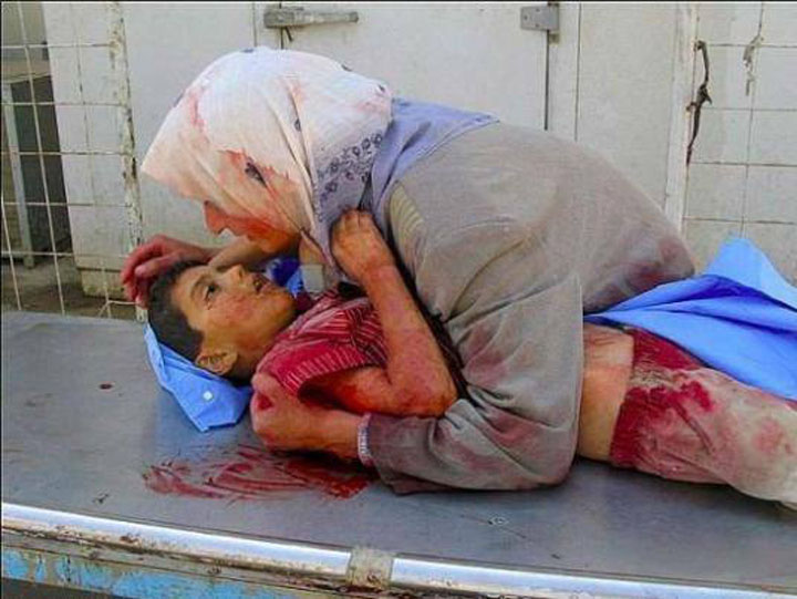 Zilnic sunt ucisi copii in Siria! Obama se ascunde dupa fustele Israelului