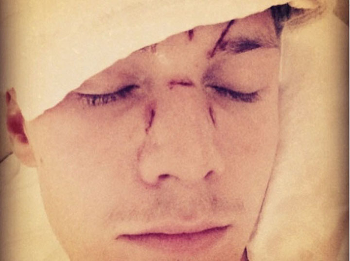 Fratele lui Paris Hilton, batut la comanda lui Lindsay Lohan