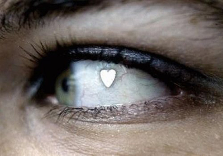Fita care face inconjurul globului ocular. Tu ti-ai baga asa ceva?