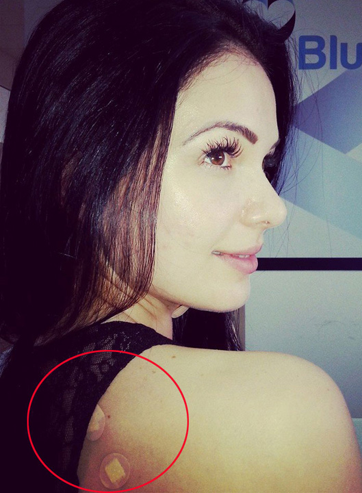 Nevasta lui Dinu Maxer a scos niste excrescente noi pe piele!