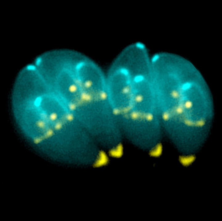 toxoplasma medalion - Ziarul National