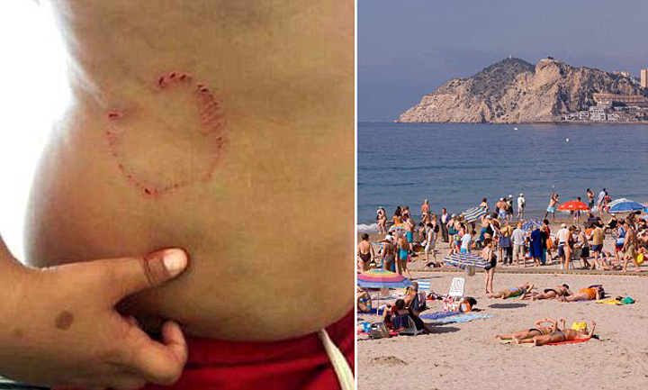 Panica in Benidorm! Un copil a fost muscat de un peste barracuda „deghizat” in rechin!