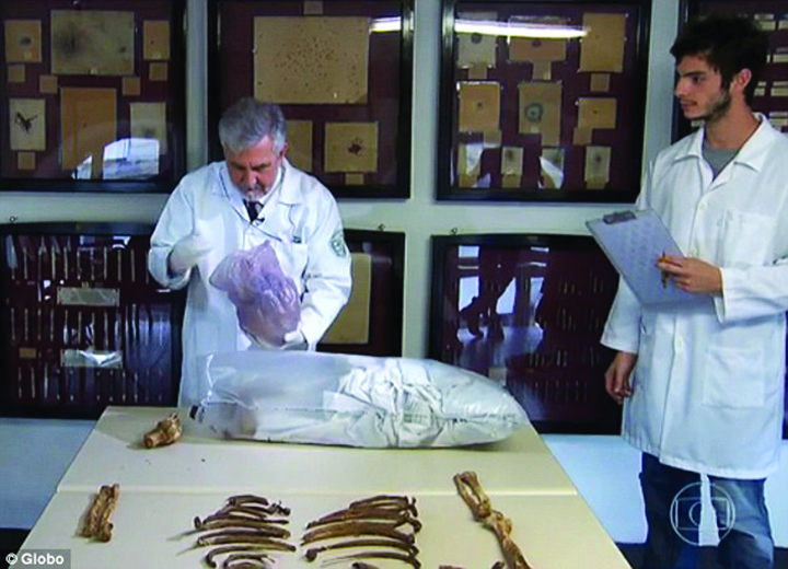 Un profesor din Brazilia a primit dreptul de a folosi oasele criminalului de razboi Josef Mengele ca material didactic