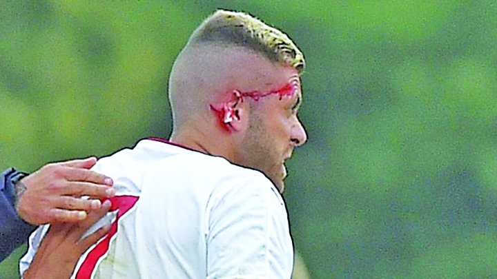 Macabru! Fotbalist de top, ramas fara ureche