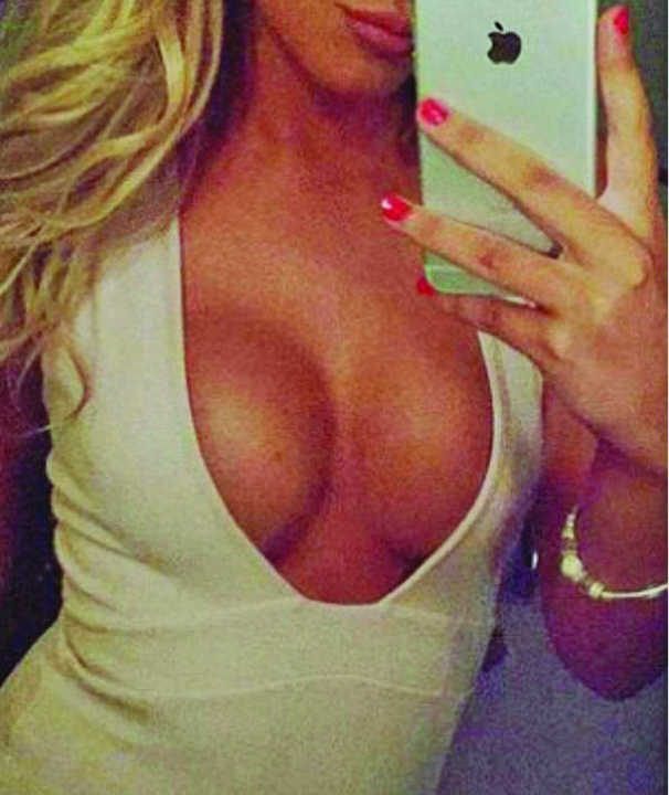 Isi vinde implanturile mamare pe eBay: „Sunt ieftine, sterile si au fost folosite doar 11 luni!”