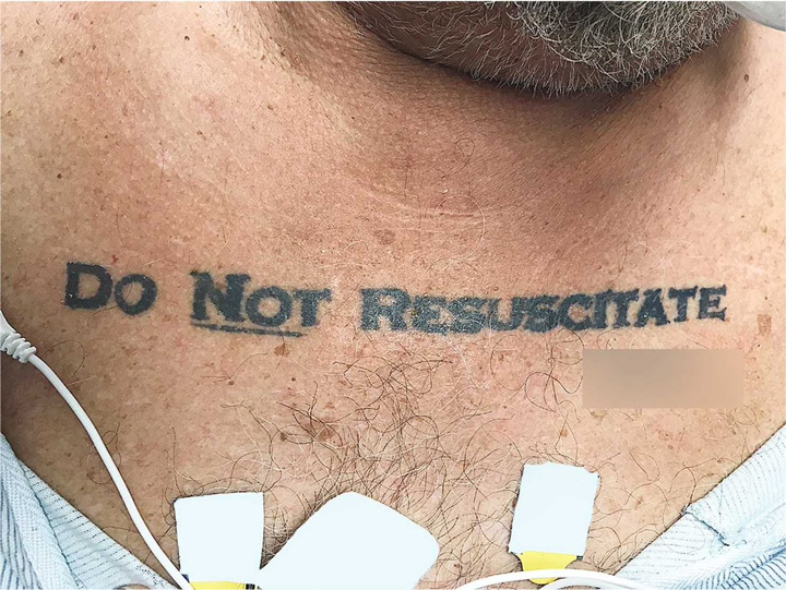 Nu ma resuscitati