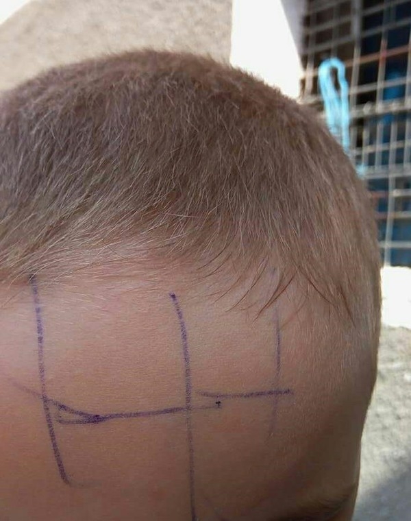 Ancheta. Educatoarea a scris cu pixul pe fruntea unui copilas