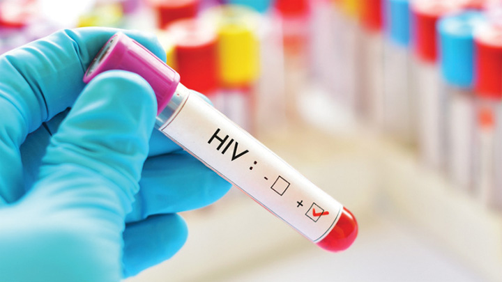 160.000 de noi cazuri HIV in Europa