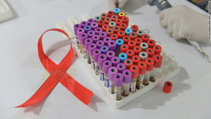 A doua persoana din lume vindecata de virusul HIV