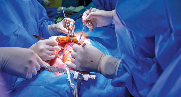 transplant - Ziarul National