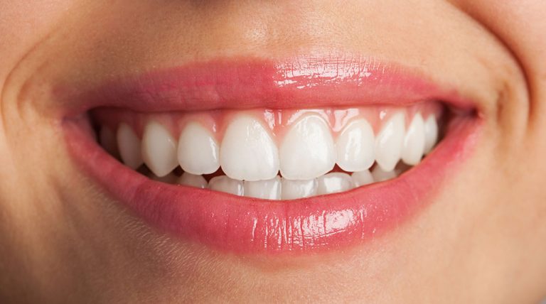 Este implantul dentar o solutie de tratament potrivita pentru tine?