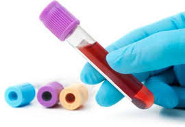 Încă un român aflat în străinătate a murit după infectarea cu COVID-19