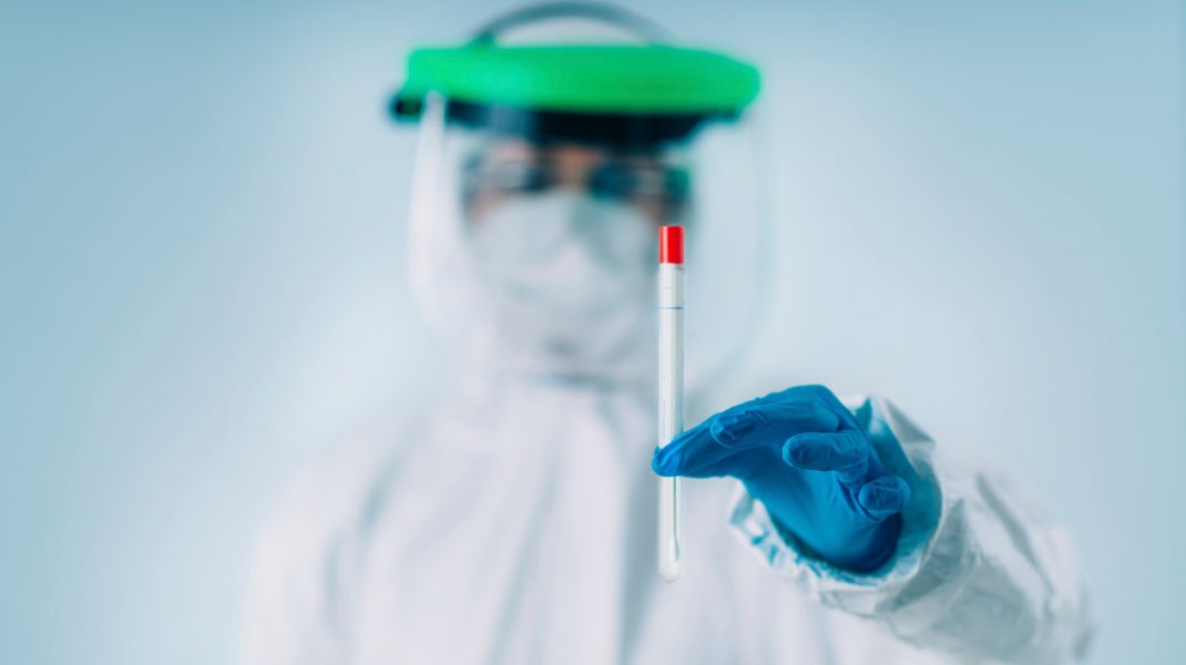 coronavirus