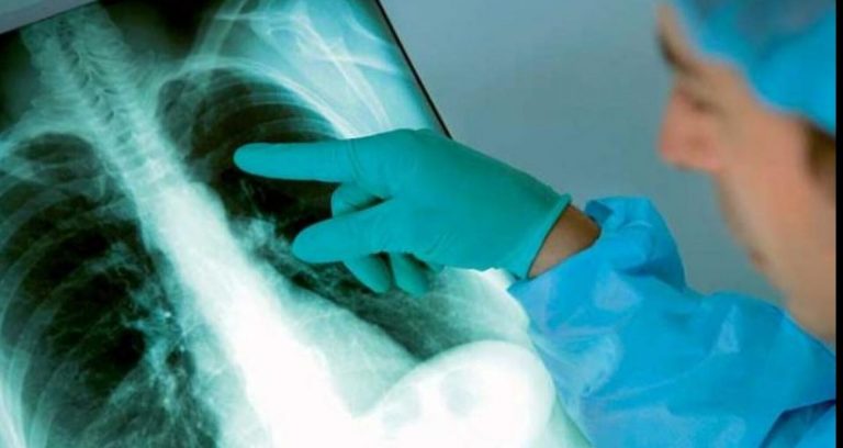 De Ziua Mondială a luptei împotriva Tuberculozei – parteneriat între Consiliul Județean Ilfov, Institutul de Pneumoftiziologie Marius Nasta și Asociația Română Anti-SIDA (ARAS)
