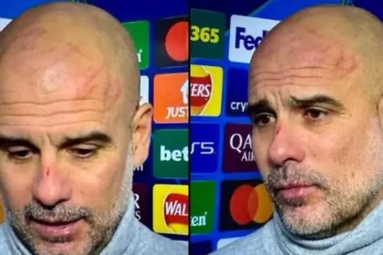 Guardiola, apariție tulburătoare. Zici că s-a luptat cu ursul!