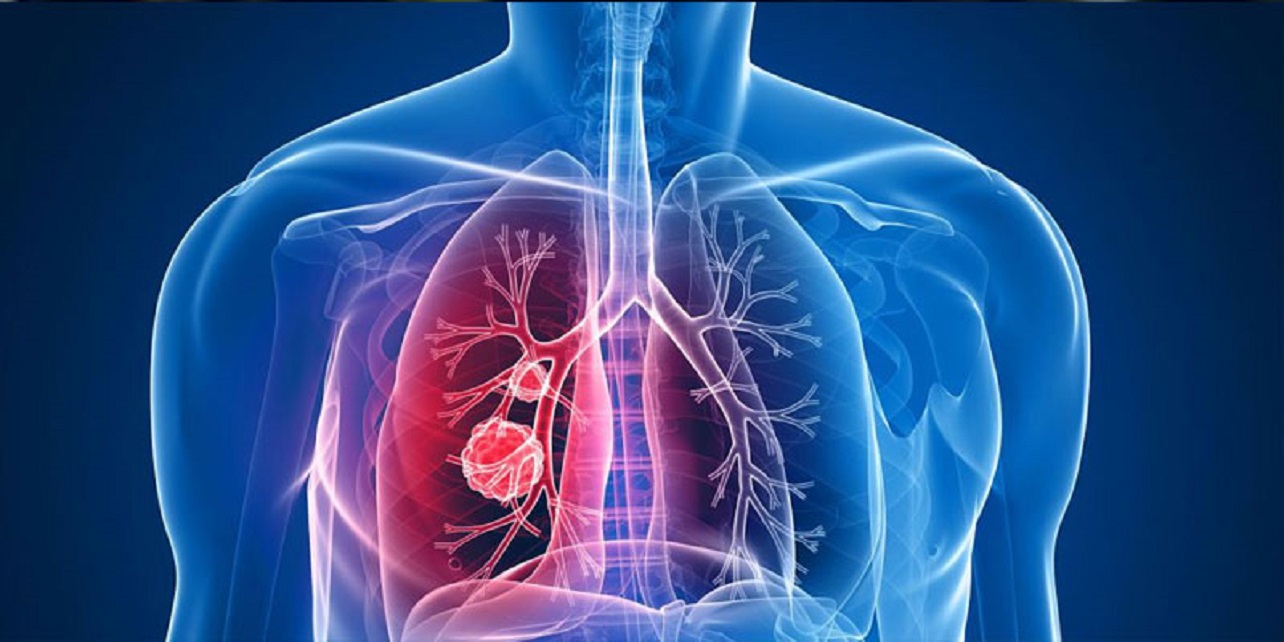 sanatatea-pulmonara - Ziarul National fructele