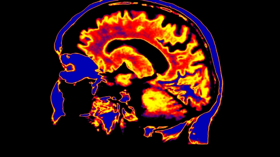 Cum se schimbă creierul la 30, 40 și 60 de ani – surprizele vârstelor și cum să îți menții mintea tânără - Ziarul National
